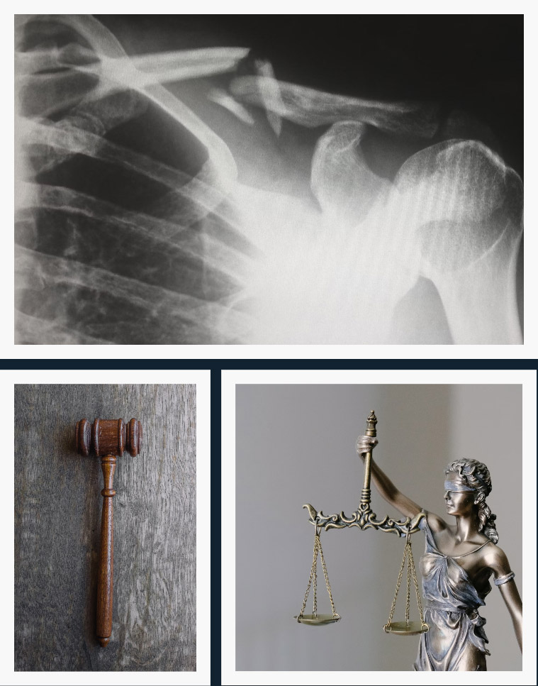 Personal Injury Lawyer Atlanta GA